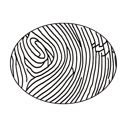 Custom Oval Brace Engraving